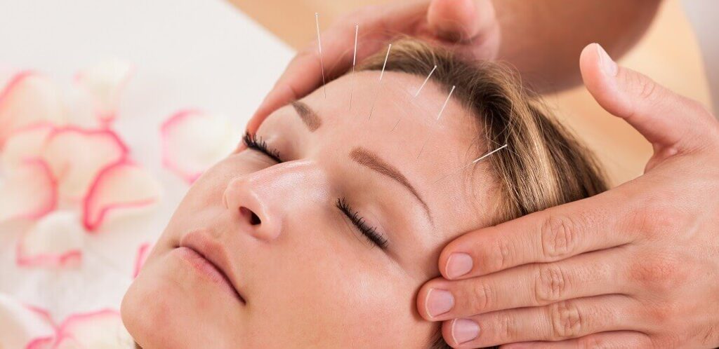 Is Acupuncture Safe? What You Need to Know